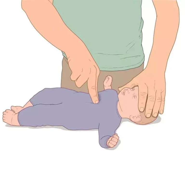 در صورت خفگی نوزاد چه باید کرد؟ + علائم و علت های خفگی 
