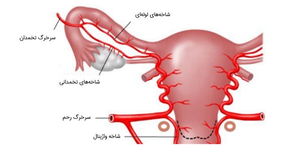 چرا باید افتادگی رحم را جدی بگیریم؟ درمان افتادگی رحم و مثانه